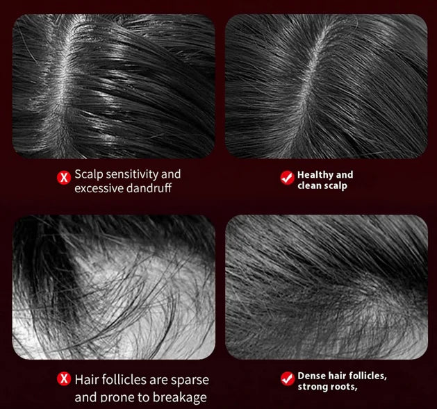 LED Hair Growth Scalp Massager Comb - 50% OFF Today Only