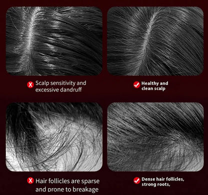 LED Hair Growth Scalp Massager Comb - 50% OFF Today Only