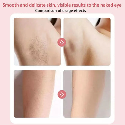 SilkGlow™ Bikini Trimmer - 50% OFF Today Only🚨